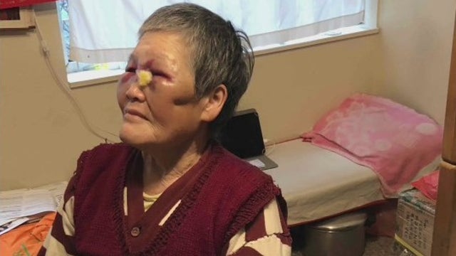 SFPD arrest suspect who assaulted elderly Asian victims in unprovoked attack Wednesday