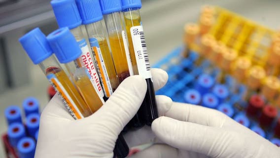 Researchers develop blood test that could help gauge depression, bipolar disorder