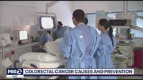 Earlier screenings recommended to prevent colon cancer