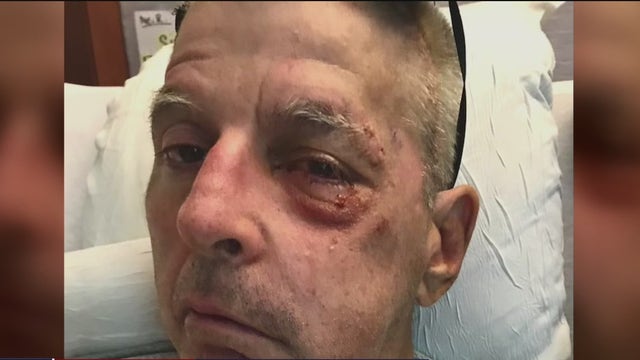 Family speaks out after victim hit by own truck during SF theft