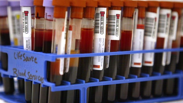 Stanford Blood Center faces emergency need for all blood types