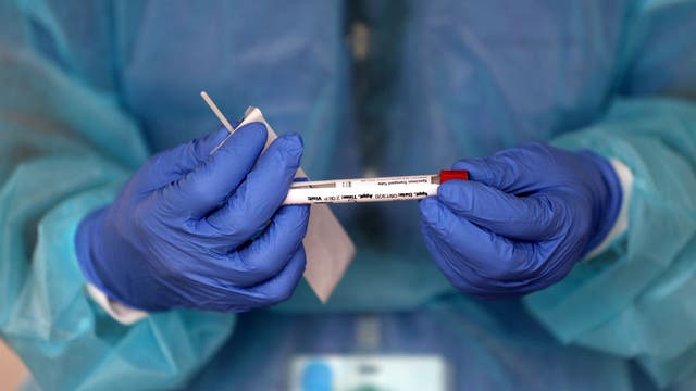 States dial back coronavirus reporting just as COVID-19 cases surge