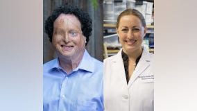 Blind adaptive technology designer, Stanford neuro-oncologist among winners of 2021 MacArthur 'genius' grant