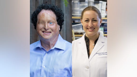 Blind adaptive technology designer, Stanford neuro-oncologist among winners of 2021 MacArthur 'genius' grant