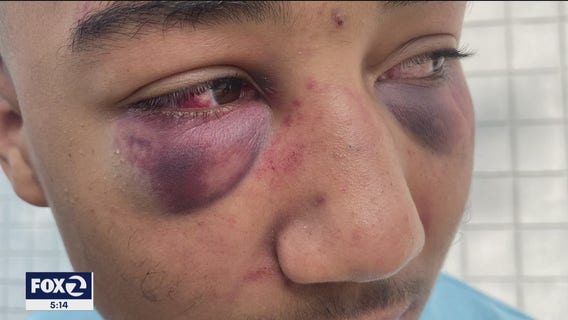 Two former Stockton police officers indicted on felony charges in beating of teen