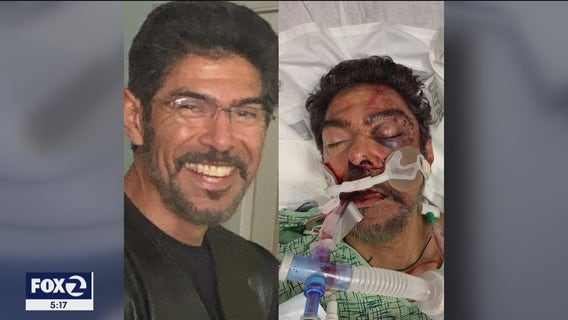San Jose father brutally beaten after crash was trying to exchange info, cops say