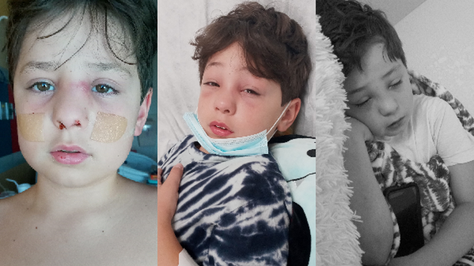 ad244727-Emmett was diagnosed with COVID-19 and it quickly became an infection in his sinus cavity. Photos by Corina Lee