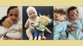 'A Doll Like Me': Helping children with disabilities feel seen through personalized dolls