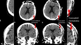 Life may indeed flash before our eyes when we die, brain wave study suggests