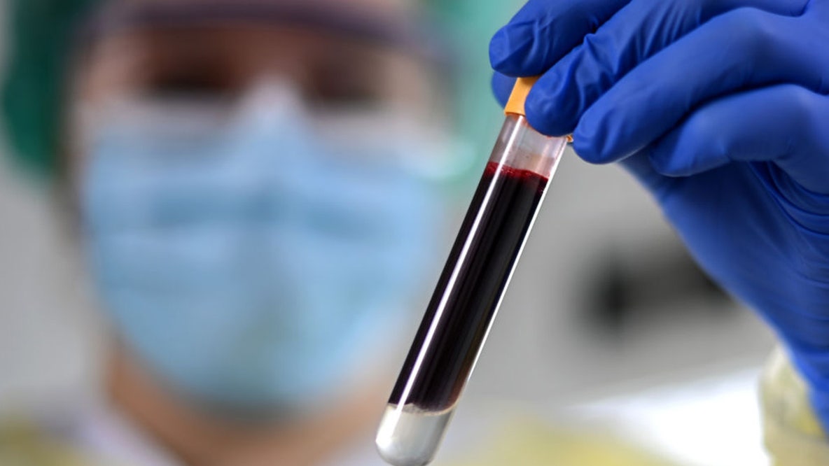 Bay Area biotech's groundbreaking blood test to detect 50+ cancers gets FDA panel approval