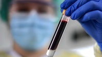 Bay Area biotech's groundbreaking blood test to detect 50+ cancers gets FDA panel approval