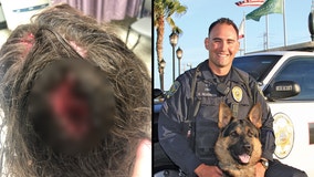 Brentwood police dog bit second woman in head, records reveal