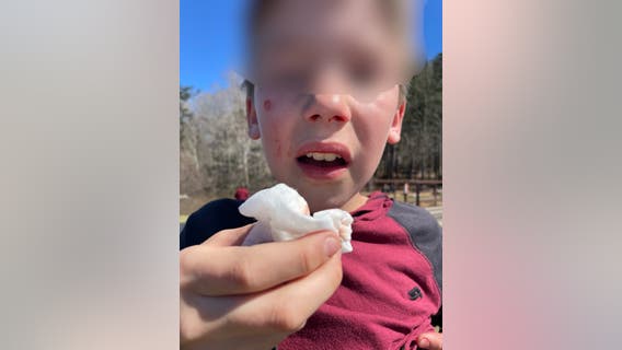 Orbeez gel balls present 'danger to the public,' police warn