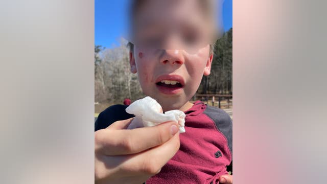 Orbeez gel balls present 'danger to the public,' police warn