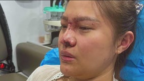 Cambodian woman attacked at San Leandro Safeway parking lot