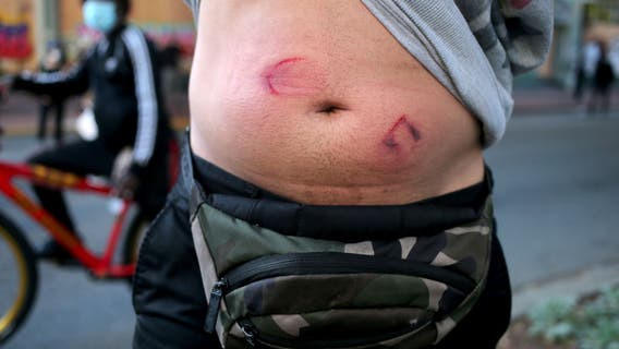 George Floyd demonstrators sue Alameda County Sheriff over tear gas, grenade use