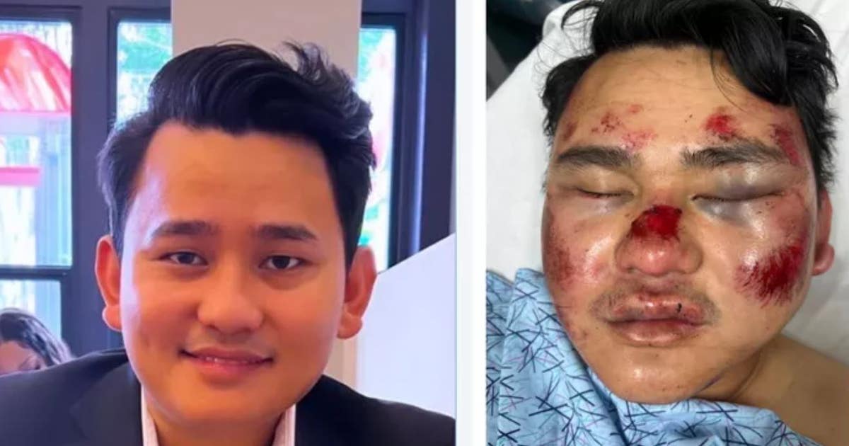Attack on Asian man in Oakland shows AAPI hate is still problem ...