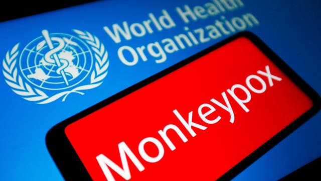 LA County reports 1st presumptive case of monkeypox