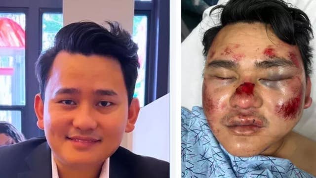 Attack on Asian man in Oakland shows AAPI hate is still problem, activist says