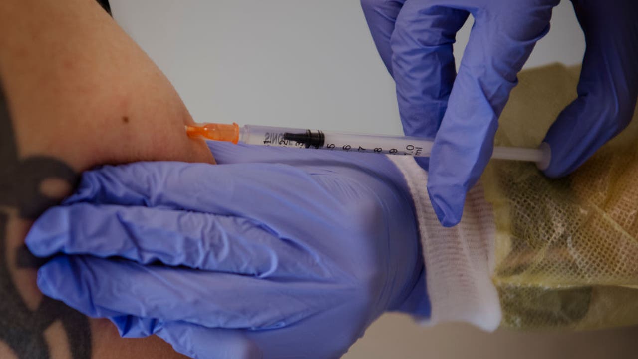 Santa Clara County Expands Eligibility for Monkeypox Vaccine