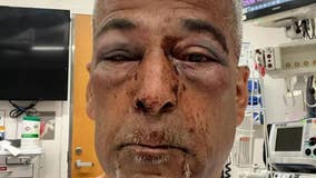 Nonprofit leader attacked with wooden plank in San Francisco's Fillmore District, man arrested