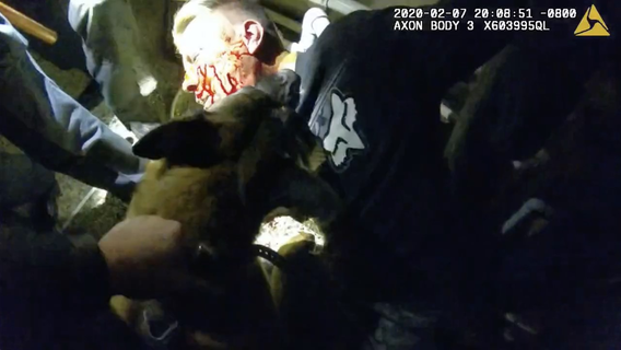 San Jose to pay $1.6M after K-9 bites man's neck for 1 minute