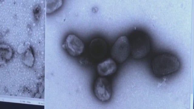 Person who was isolated at SF jail tests negative for monkeypox