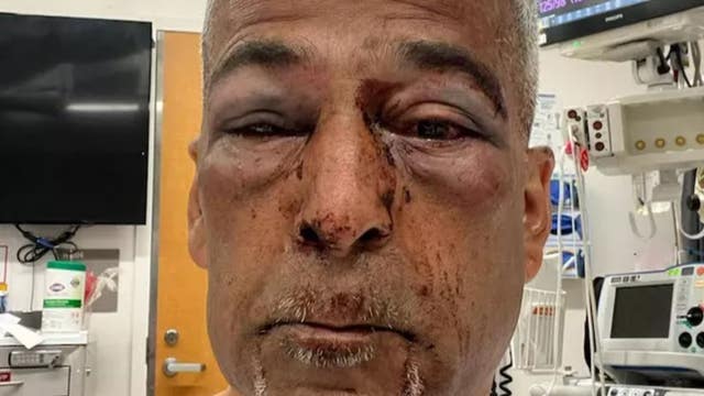Second suspect arrested in brutal beating of San Francisco community leader