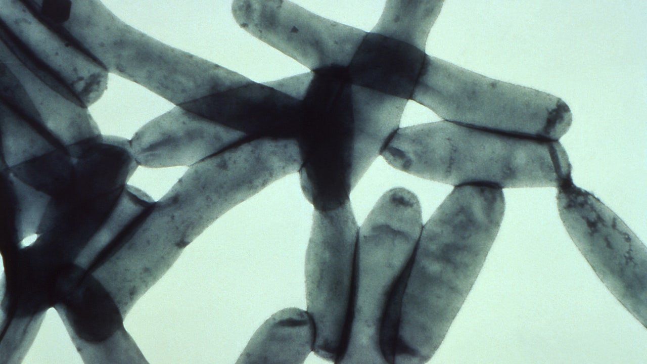 Outbreak of Legionnaires' disease in Napa County causes one death - Vimarsana News