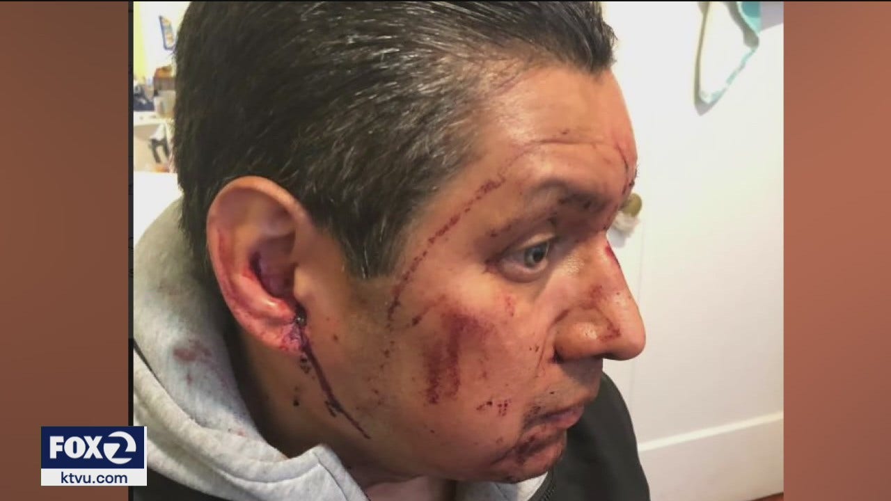 Police search for man who brutally attacked father in San Francisco’s Mission