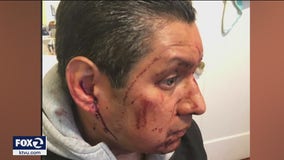 Police search for man who brutally attacked father in San Francisco's Mission