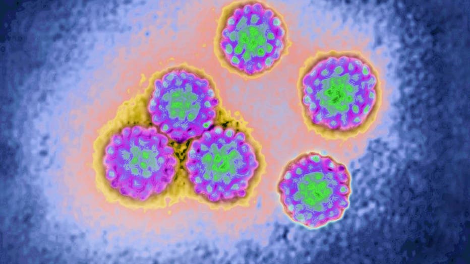 Papillomavirus