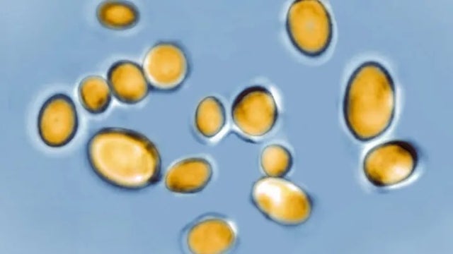 Potentially deadly fungal infections climb during COVID pandemic, WHO says