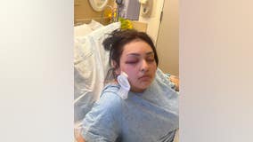 Antioch Habit Burger manager loses eye in attack; suspect on the loose