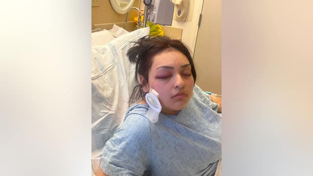 Antioch Habit Burger manager loses eye in attack; suspect on the loose