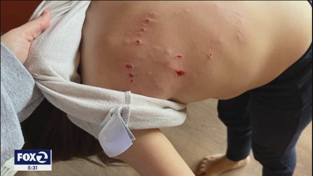 Pitbull attacks for third time, neighbors call for dog to be euthanized