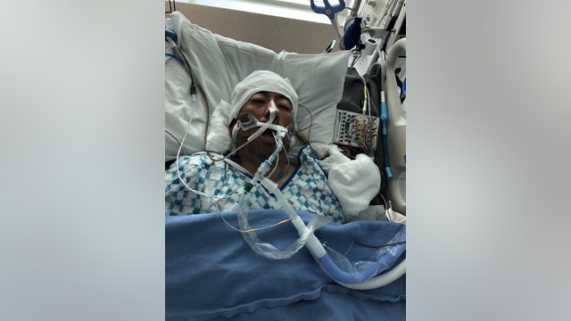 Authorities seek help identifying patient at Zuckerberg Hospital