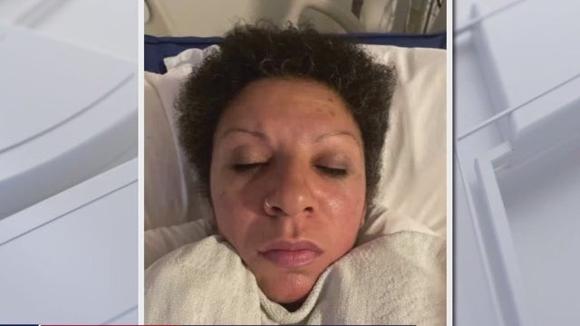 UCSF needs help in identifying patient with tattoos, neck scar
