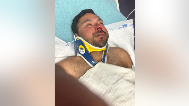 Man savagely beats San Jose street food vendor