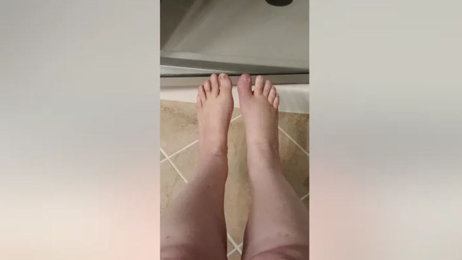 Georgia-woman-loses-toe-pedicure-III.jpg