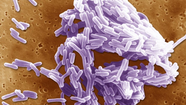At least 10 people sickened in US listeria outbreak linked to prepared foods