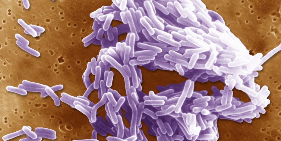 At least 10 people sickened in US listeria outbreak linked to prepared foods