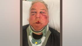 Danville man says he was attacked over a parking spot