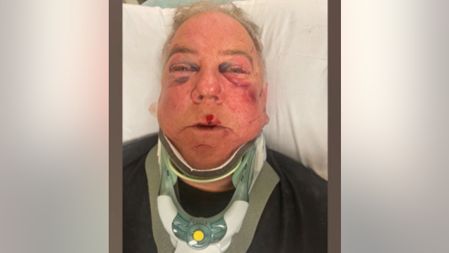 DA will not file charges after man says he was brutally attacked in Danville Costco