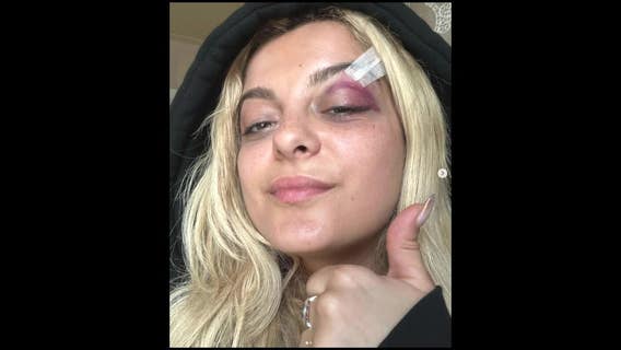 Bebe Rexha drops to knees after being hit by phone during NYC show; suspect facing felony charges