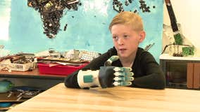9-year-old boy gets prosthetic hand thanks to South Bay 8th grade tech class