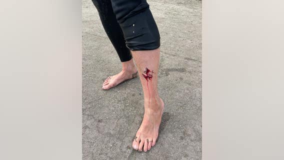 Surfer injured in possible Pacifica shark bite