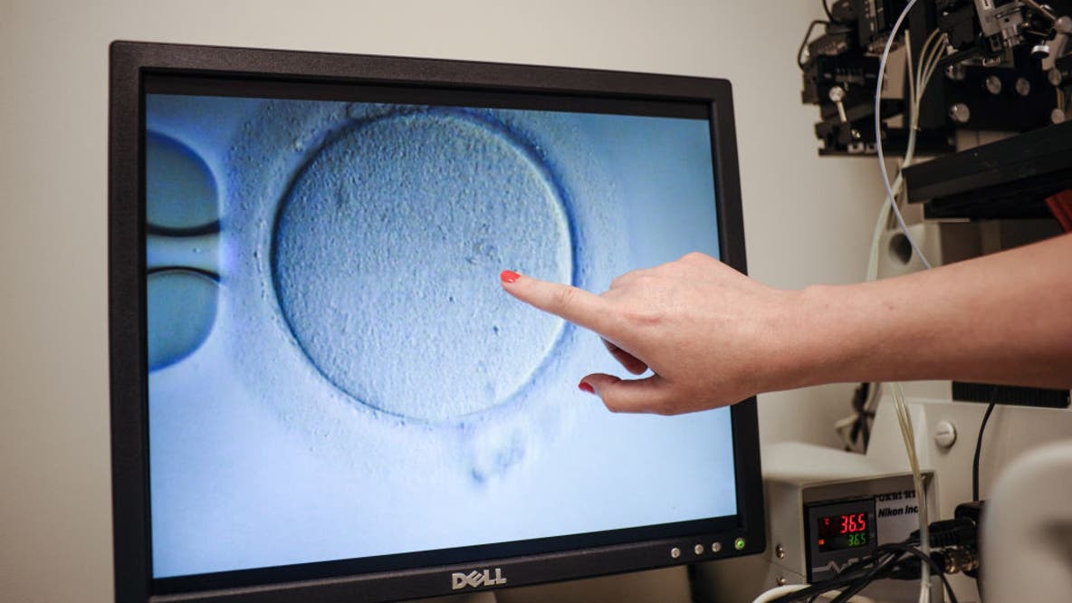 Millions of Californians gain access to in vitro fertilization under new law