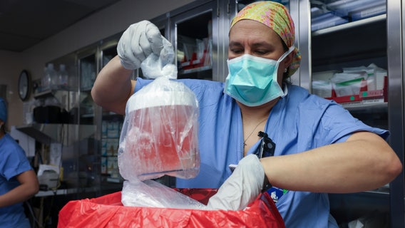 Pig kidney transplanted into man in surgical first