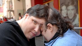 Oldest living conjoined twins, Lori and George Schappell, die at 62